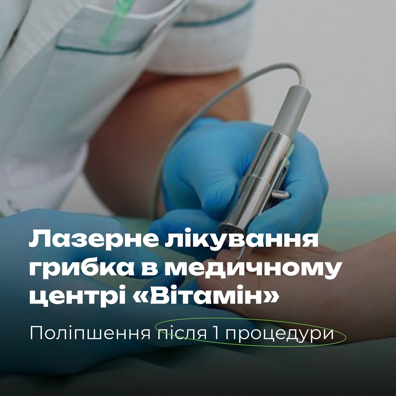 Позбудьтесь грибка нігтів без болю та неприємних відчуттів всього лише за декілька процедур! - Медичний центр Вітамін