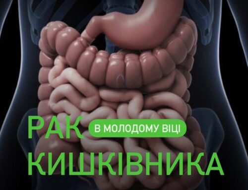 Рак кишківника (колоректальний рак) у молодому віці: важлива інформація