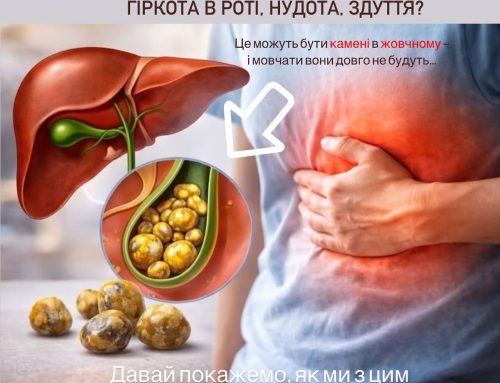Підозра на камені в жовчному?Не чекайте болю, нудоти чи ускладнень.