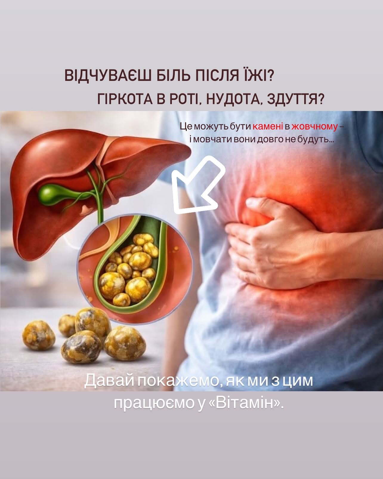 Підозра на камені в жовчному?Не чекайте болю, нудоти чи ускладнень. - Медичний центр Вітамін