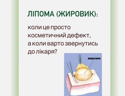 «Це просто жировик…»Саме так часто кажуть люди, коли помічають під шкірою невелике ущільнення.